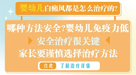 婴幼儿白癜风的治疗方法都有哪些