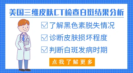 皮肤镜检查能确诊白癜风吗