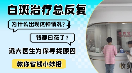 白癜风眉毛变白这个病情严重吗