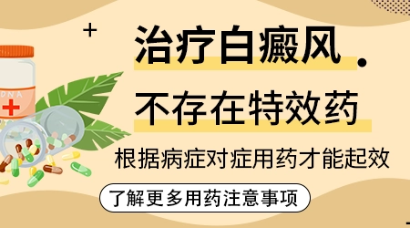 白斑特效药第一名