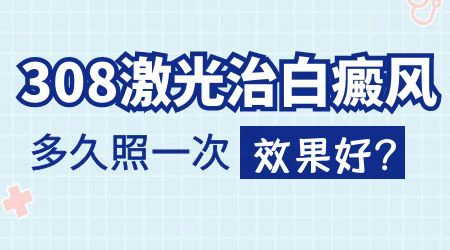 儿童白癜风照308一周照几次