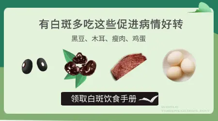 得了白癜风吃什么能恢复