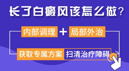 白癜风能不能治好 治疗白癜风的新方法