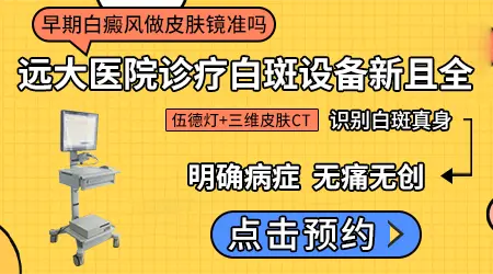 伍德灯和皮肤镜能确诊白癜风吗