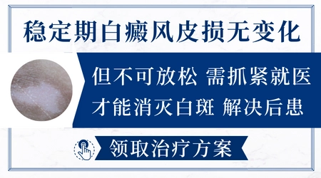 什么样的白癜风才算是稳定期