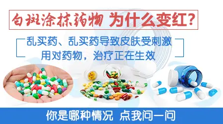 白斑抹几天药有点微红怎么回事