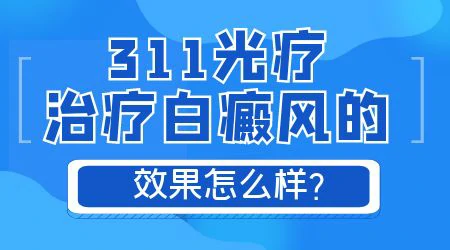 白癜风能不能用紫外线灯照射