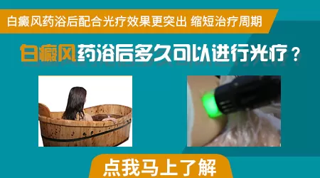 白癜风药浴配方都是什么