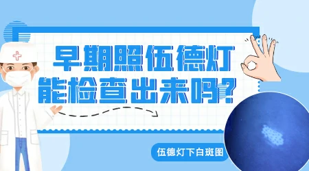 伍德灯下白斑亮白色严重吗