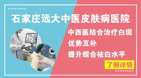 308激光照多久能照出黑色素