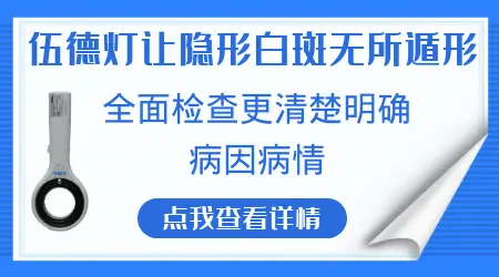 如果白癜风治疗了伍德灯还能看出来吗