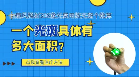 308激光治疗白斑一次多少钱