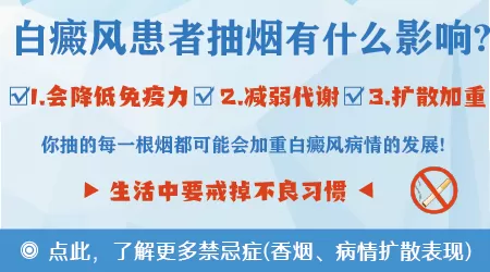 男性白癜风喝酒抽烟会导致白斑增多吗