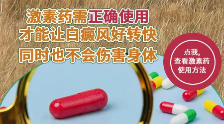 白癜风白斑吃了激素药有不复发的吗