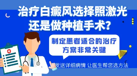 白癜风做种植好还是照308激光好