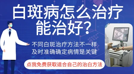 汗斑和白癜风白斑图片对比