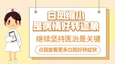 如果白癜风治疗了伍德灯还能看出来吗