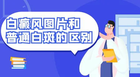 白斑和白癜风的区别图