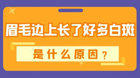 眉毛上白斑的症状