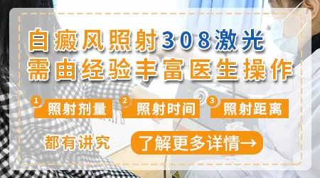 308激光照白癜风需要每天都做吗