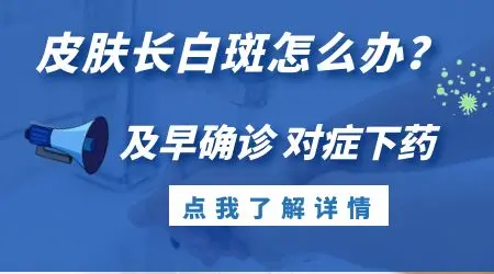 白癜风和贫血痣的区别是什么