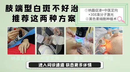 治肢端白癜风的新型技术