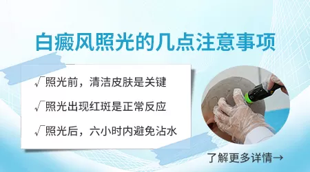 308激光治疗白斑价格治疗