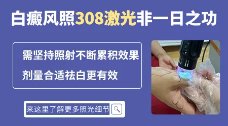 脸上许多白斑照308激光效果如何