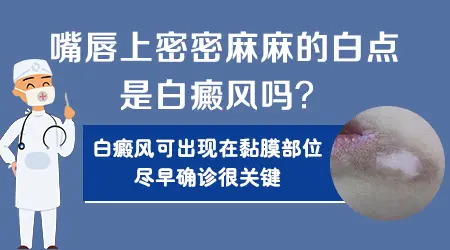 为什么上嘴唇下面是白的