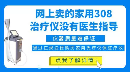 网上的308激光治疗仪靠谱吗