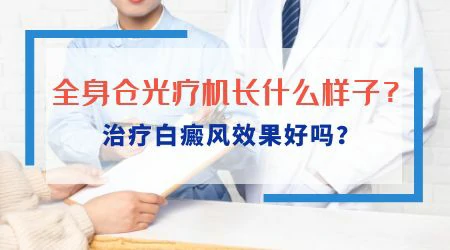 全身仓治疗白癜风的费用贵不贵