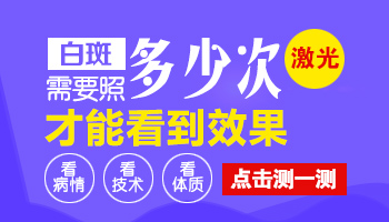 白癜风照308的话要照多少次才能照好