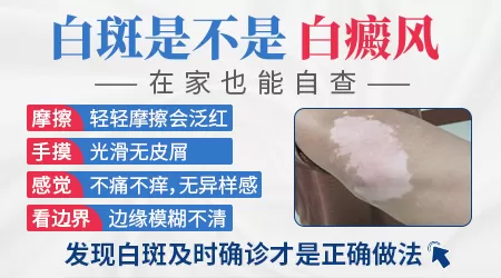 脖子上长了小白点是白癜风吗