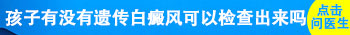 胎儿有没有遗传白癜风孕检能检查出来吗