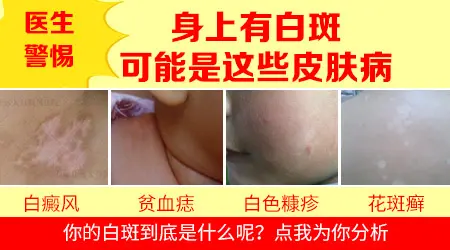 手臂上出现小白斑图片