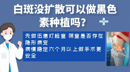 黑色素细胞种植治白癜风怎么收费