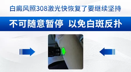 网上的308激光治疗仪靠谱吗