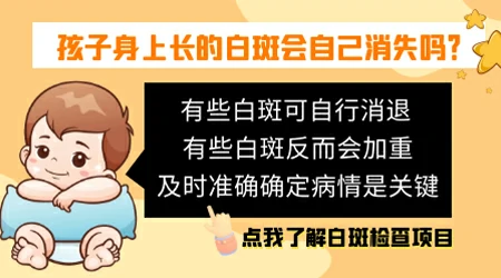 小孩子长白斑怎么去掉