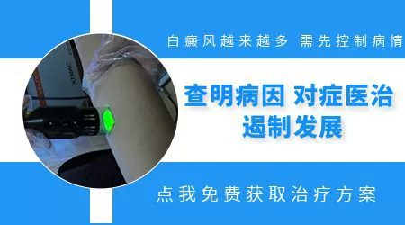 小孩身上有白斑变多该怎么控制