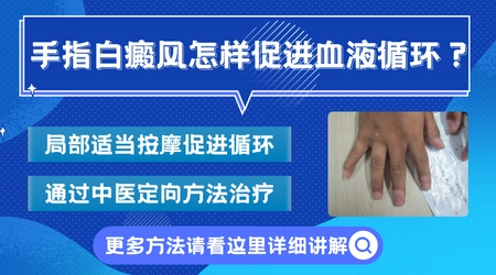 手指上有白斑做什么检查