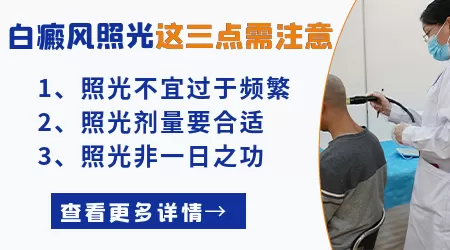 进口308激光跟国产308激光有什么区别