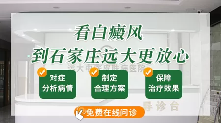 如何预防白斑扩散到其他位置