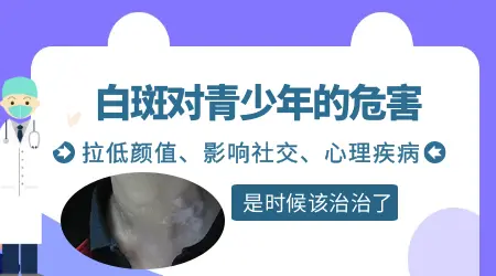 青少年白癜风的原因是什么