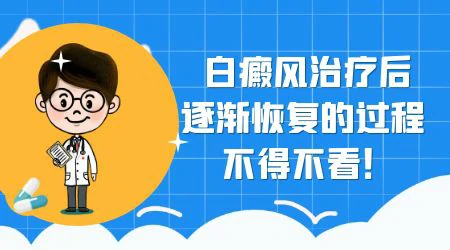 白斑照308激光恢复过程图