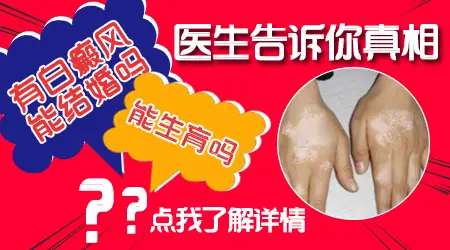 男性生殖部位有<a href=https://www.bdfcctv.com/zhiliao/ target=_blank class=infotextkey>白癜风治疗</a>会影响生育吗