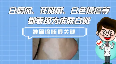 胳肢窝出现了小白块是什么原因