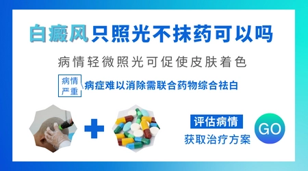 白癜风只抹药不照光行不行