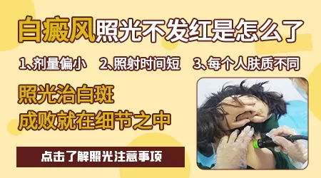 白癜风照308激光后没反应正常吗