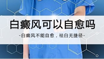 白癜风不照激光会自行消失吗